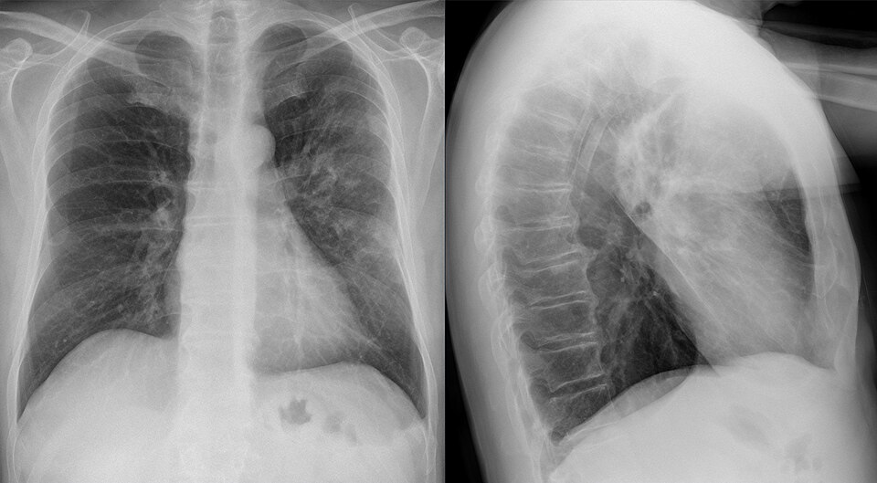 Understanding Legionnaires’ Disease: Causes, Risks & Prevention